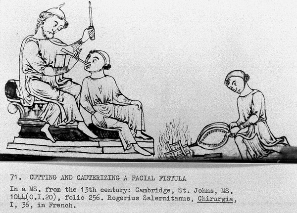 Miniature: surgeon cutting facial fistula