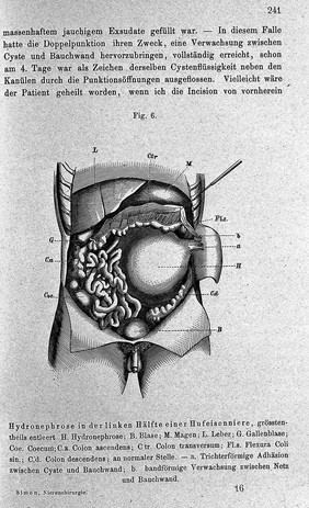 Chirurgie der Nieren / von Gustav Simon.