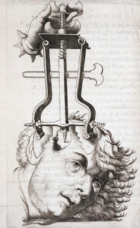 Succenturiatus anatomicus. Continens commentaria in Hippocratem, de capitis vulneribus. Additae in aliquot capita libri VIII C. Celsi explicationes ... / [Pieter Pauw].