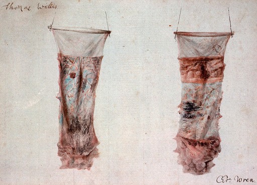 Typhoid lesions in small intestine, T. Willis & C. Wren