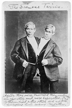 Chang and Eng 1811-1874.