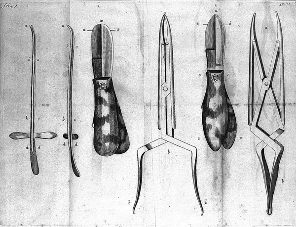 Parallele des differentes manieres de tirer la pierre hors de la vessie / [Henri François Ledran].