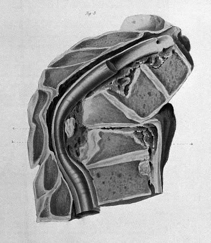 Illustrations of the effects of disease and injury of the bones, with descriptive and explanatory statements / By Edward Stanley.