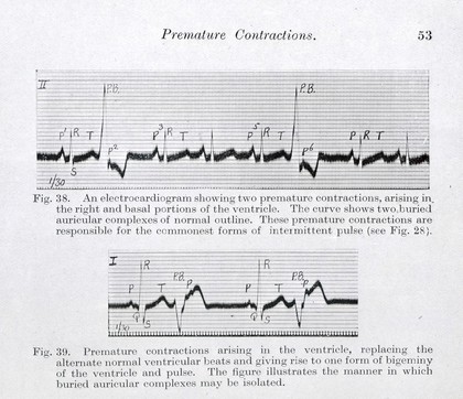 Clinical electrocardiography / by Sir Thomas Lewis.