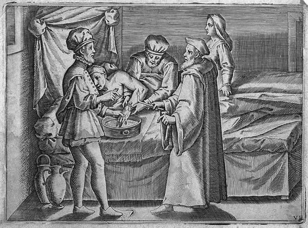 A surgeon consulting an older surgeon before bleeding an man's hand, he is aided by an assistant and a woman. Engraving, 1586.