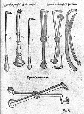 Les œuvres d'Ambroise Paré ... Diuisees en vingt huict liures, auec les figures et portraicts, tant de l'anatomie, que des instruments de chirurgie, et de plusieurs monstres. Reueuës et augmentees par l'autheur.