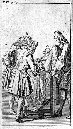 Traité des opérations de chirurgie, fondé sur la mécanique des organes de l'homme, et sur la théorie et la pratique la plus autorisée ... / [René-Jacques Croissant de Garengeot].
