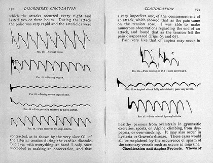 Therapeutics of the circulation / by Sir Lauder Brunton.