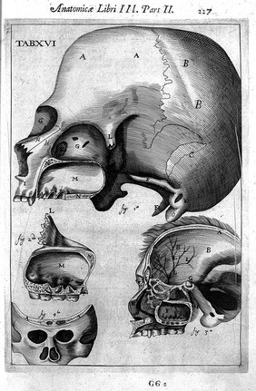 Skull from Highmore, Corporis humani disquisitio anatomica, 1651