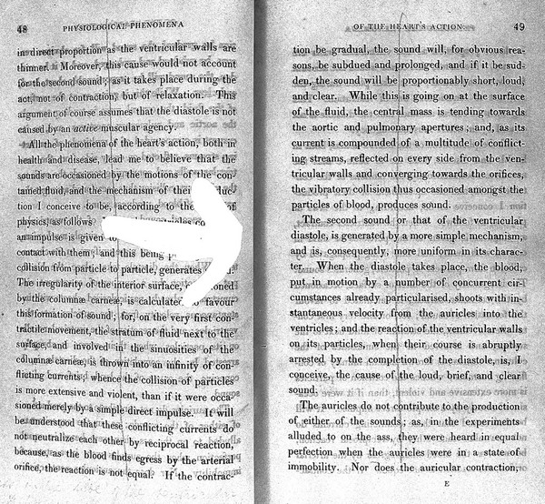 A treatise on the diseases of the heart and great vessels, comprising a new view of the physiology of the heart's action, according to which the physical signs are explained / [James Hope].