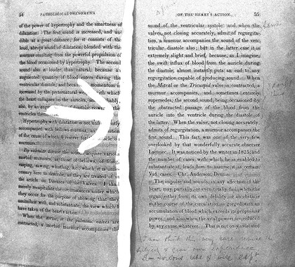 A treatise on the diseases of the heart and great vessels, comprising a new view of the physiology of the heart's action, according to which the physical signs are explained / [James Hope].