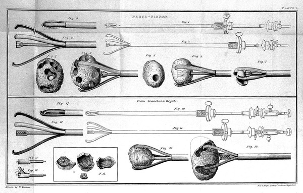 Principles of lithotrity; or a treatise on the art of extracting the stone without incision / By Baron Heurteloup.