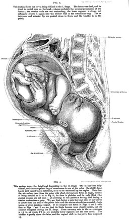 The anatomy of labour : including that of full-time pregnancy and the first days of the puerperium exhibited in frozen sections reproduced ad naturam / by A.H.F. Barbour.