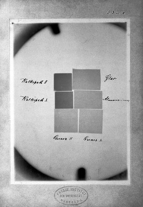 Radiograph: six blocks of various substance.