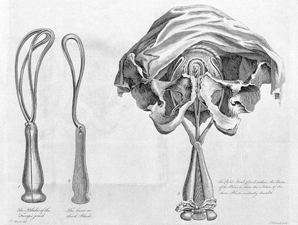 A lecture introductory to the theory and practice of midwifery : including the history, nature and tendency of that science, with a view of its several branches, and a proper means of attaining a perfect knowledge of the whole together with animadversions on the qualification and deportment of an accoucheur publicly delivered the 4th of October, 1773 / by John Leake.