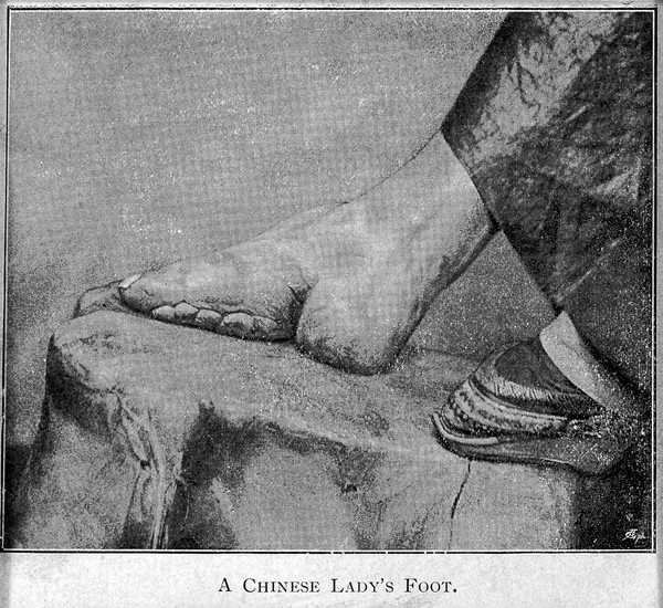 A Chinese lady's foot.