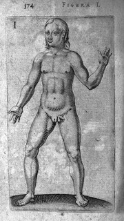 Hermaphrodite from De Hermaphroditorum, 1614