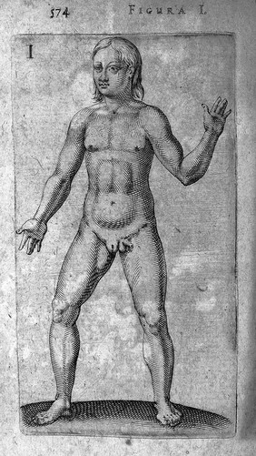 Hermaphrodite from De Hermaphroditorum, 1614