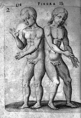 Hermaphrodite twins from De Hermaphroditorum, 1614