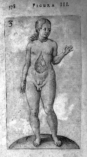view Hermaphrodite from De Hermaphroditorum, 1614