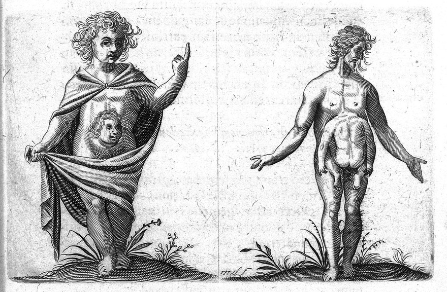 De monstrorum caussis, natura, et differentiis libri duo.