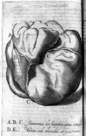 De recondita abscessuum natura libri VII / [Marco Aurelio Severino].