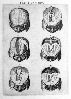 Syntagma anatomicum. Locis plurimis actum, emendatum ... / [Johann Vesling].