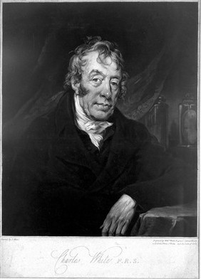 Charles White. Mezzotint by W. Ward after J. Allen.