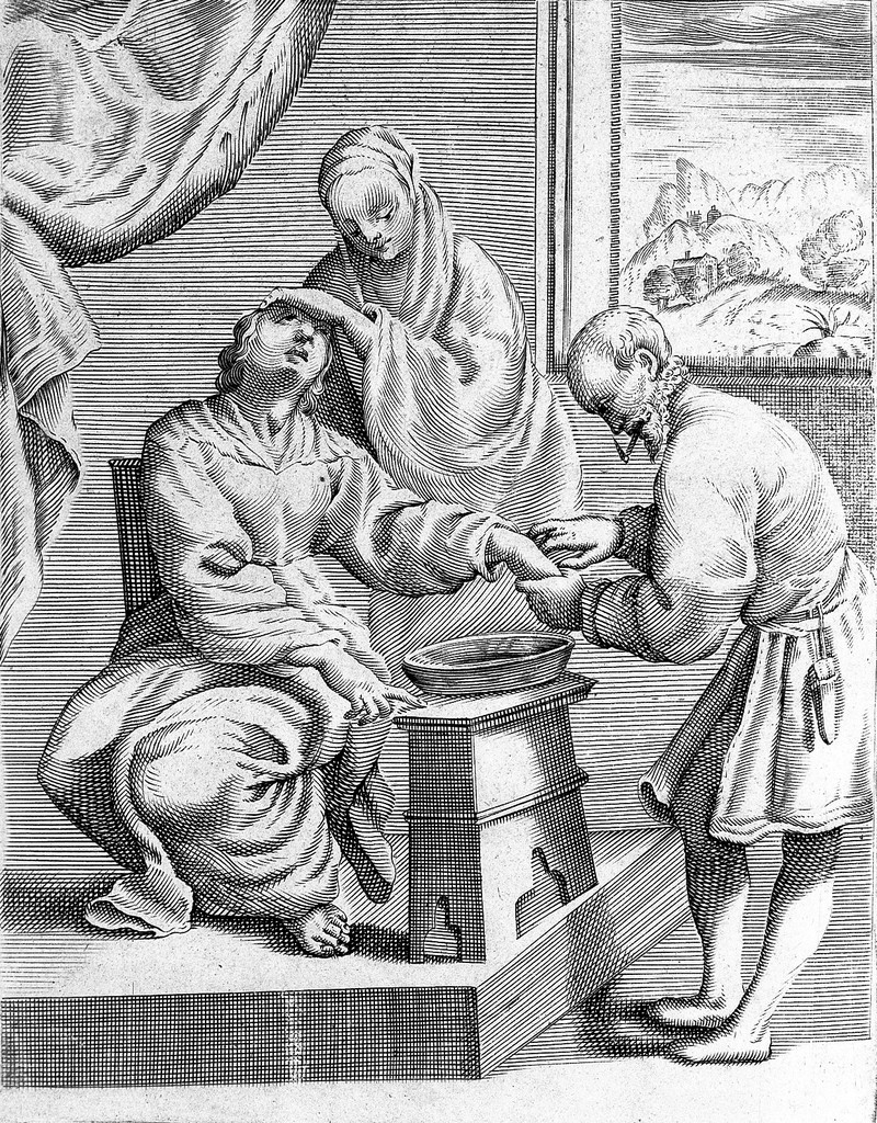 Bloodletting from the hand Collection