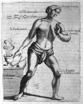 Il barbiere ... libri tre. Ne' quali si ragiona dell'eccellenza dell'arte, e de' suoi precetti. Delle vene, e regole d'aprirle. Dell'applicatione de' remedi chirurgici appartenenti al mestiere. Con figure anatomiche e di nuovi strumenti.