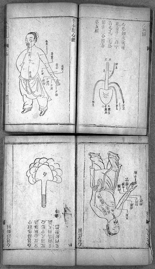 Yang Chi-chou, A compendium of acupuncture and cauterization.