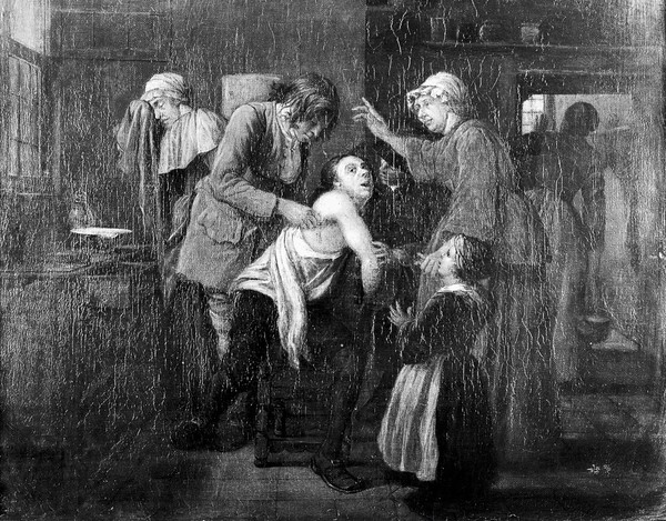 A surgical operation. Oil painting by or in the style of Jan Josef Horemans I.