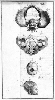 An essay towards a complete new system of midwifry, theoretical and practical. Together with the descriptions, causes and methods of removing, or relieving the disorders peculiar to pregnant ... women, and new-born infants / [John Burton].