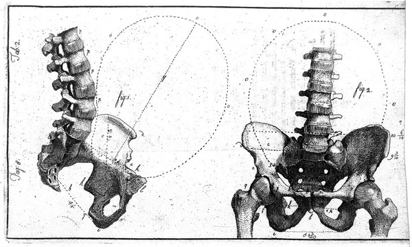 An essay towards a complete new system of midwifry, theoretical and practical. Together with the descriptions, causes and methods of removing, or relieving the disorders peculiar to pregnant ... women, and new-born infants / [John Burton].