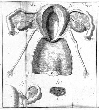 An essay towards a complete new system of midwifry, theoretical and practical. Together with the descriptions, causes and methods of removing, or relieving the disorders peculiar to pregnant ... women, and new-born infants / [John Burton].