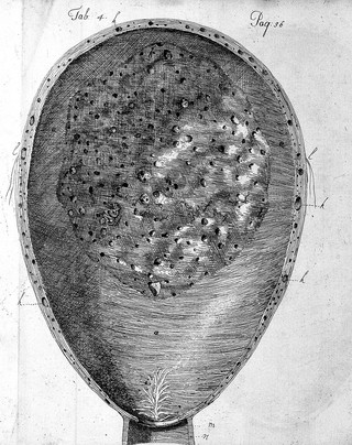 An essay towards a complete new system of midwifry, theoretical and practical. Together with the descriptions, causes and methods of removing, or relieving the disorders peculiar to pregnant ... women, and new-born infants / [John Burton].