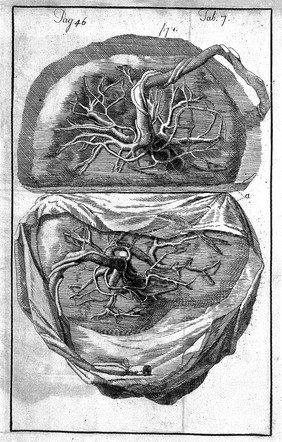 An essay towards a complete new system of midwifry, theoretical and practical. Together with the descriptions, causes and methods of removing, or relieving the disorders peculiar to pregnant ... women, and new-born infants / [John Burton].