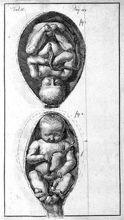 An essay towards a complete new system of midwifry, theoretical and practical. Together with the descriptions, causes and methods of removing, or relieving the disorders peculiar to pregnant ... women, and new-born infants / [John Burton].