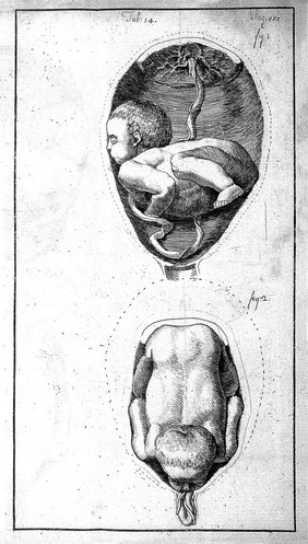 An essay towards a complete new system of midwifry, theoretical and practical. Together with the descriptions, causes and methods of removing, or relieving the disorders peculiar to pregnant ... women, and new-born infants / [John Burton].