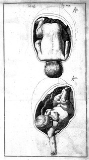 An essay towards a complete new system of midwifry, theoretical and practical. Together with the descriptions, causes and methods of removing, or relieving the disorders peculiar to pregnant ... women, and new-born infants / [John Burton].