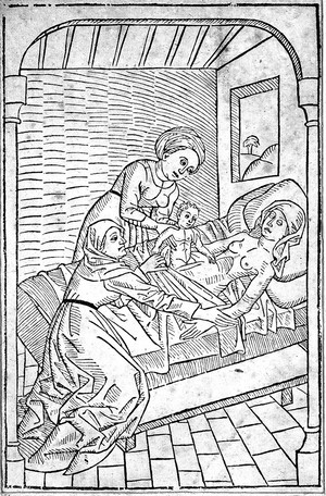 view Woodcut: birth of Anti-christ by Caesarian section, c.1483.