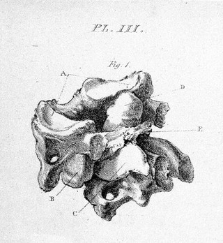 Observations on injuries of the spine and of the thigh bone: in two lectures. Delivered in the school of Great Windmill street / [Sir Charles Bell].