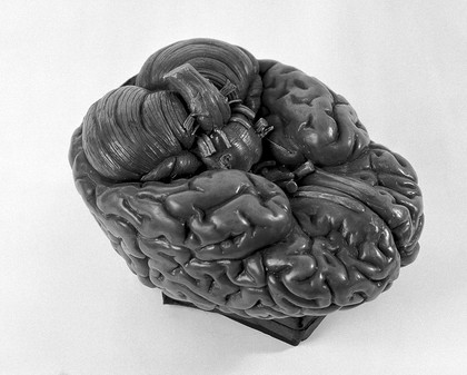 Anatomical model of human brain,