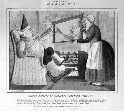 A horrified gouty man discovering grass is growing out of his skin, as a result of taking J. Morison's vegetable pills. Coloured lithograph by C.J. Grant, 1835.
