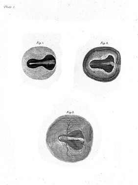 A treatise on the blood, inflammation, and gun-shot wounds / By the late John Hunter. To which is prefixed a short account of the author's life by his brother-in-law, Everard Home.