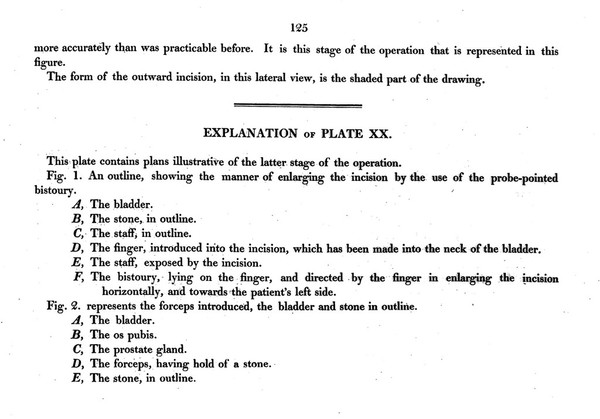 Illustrations of the great operations of surgery, trepan, hernia, amputation, aneurism, and lithotomy / [Sir Charles Bell].