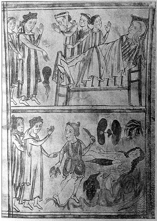 Man dissecting female corpse with physician standing by.