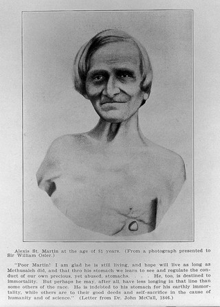 Life and letters of Dr. William Beaumont : including hitherto unpublished data concerning the case of Alexis St. Martin / by Jesse S. Myer ... with an introduction by Sir William Osler ... with fifty-eight illustrations.