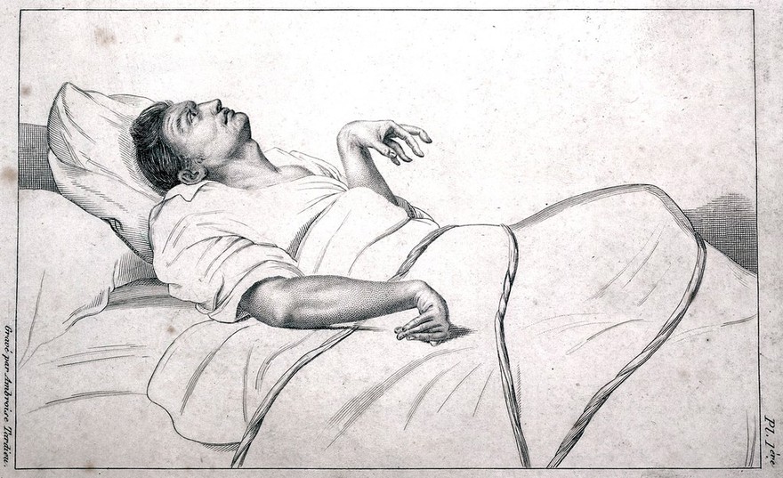 Des maladies mentales considérées sous les rapports médical, hygiénique et médico-légal / [Etienne Esquirol].