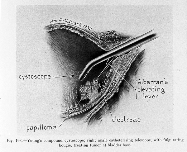 Electrosurgery / by Howard A. Kelly and Grant E. Ward ; with 382 illustrations by William P. Didusch and others.